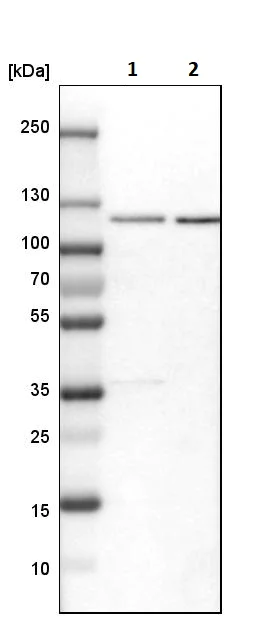 Western blot - Anti-Rbm15/OTT antibody (AB244374)