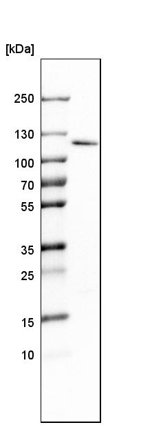 Western blot - Anti-Rbm15/OTT antibody (ab244374), expandable thumbnail