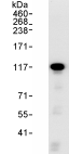Immunoprecipitation - Anti-Rbm15/OTT antibody (AB70549)