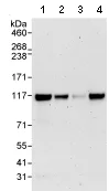 Western blot - Anti-Rbm15/OTT antibody (AB70549)
