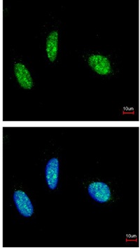Immunocytochemistry/ Immunofluorescence - Anti-Rbm15/OTT antibody (AB96544), expandable thumbnail