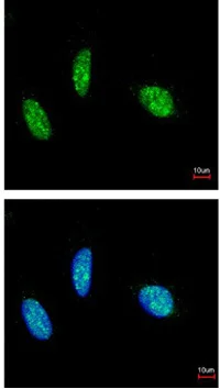 Immunocytochemistry/ Immunofluorescence - Anti-Rbm15/OTT antibody (AB96544)