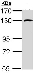 Western blot - Anti-Rbm15/OTT antibody (AB96544), expandable thumbnail