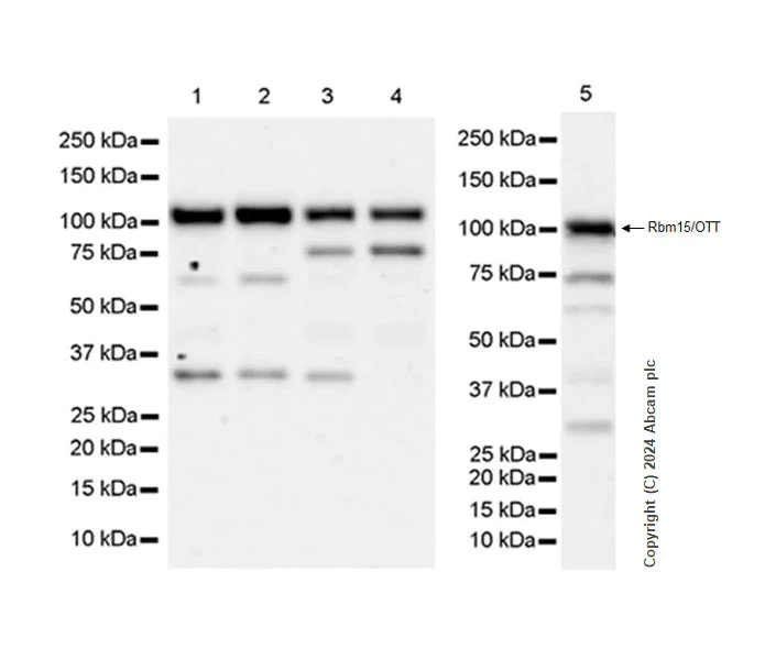 Western blot - Anti-Rbm15/OTT antibody [EPR28158-87] (AB315456)