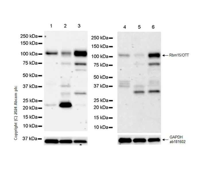 Western blot - Anti-Rbm15/OTT antibody [EPR28158-87] (AB315456)