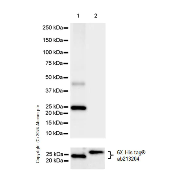 Western blot - Anti-Rbm15/OTT antibody [EPR28158-87] (AB315456)
