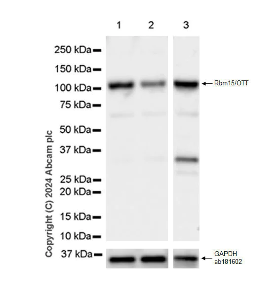 Western blot - Anti-Rbm15/OTT antibody [EPR28158-87] - BSA and Azide free (AB315457)