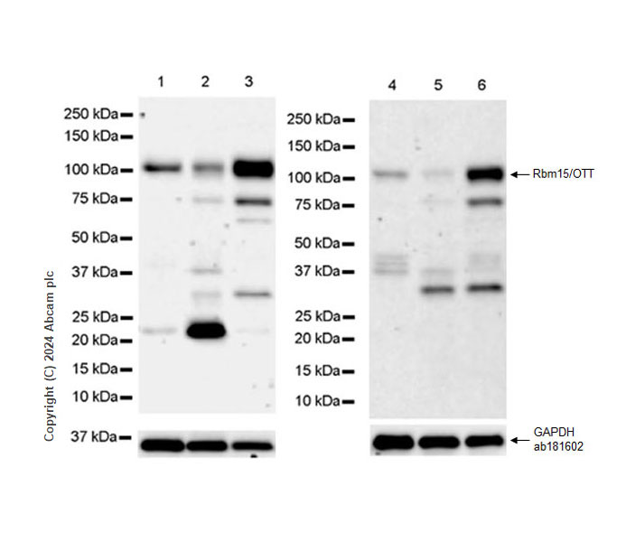 Western blot - Anti-Rbm15/OTT antibody [EPR28158-87] - BSA and Azide free (AB315457), expandable thumbnail
