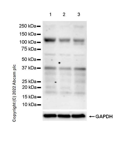 Western blot - Anti-Rbm15/OTT + RBM15B antibody [EPR25177-138] (AB300347)