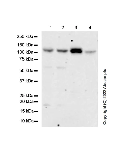 Western blot - Anti-Rbm15/OTT + RBM15B antibody [EPR25177-138] (AB300347)