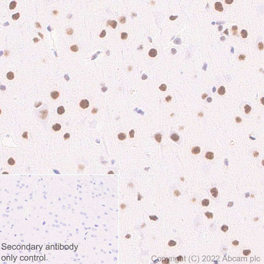 Immunohistochemistry (Formalin/PFA-fixed paraffin-embedded sections) - Anti-RBM15B antibody [EPR25177-134] (BSA and Azide free) (AB300468), expandable thumbnail