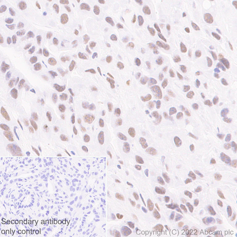 Immunohistochemistry (Formalin/PFA-fixed paraffin-embedded sections) - Anti-RBM15B antibody [EPR25177-134] (BSA and Azide free) (AB300468)