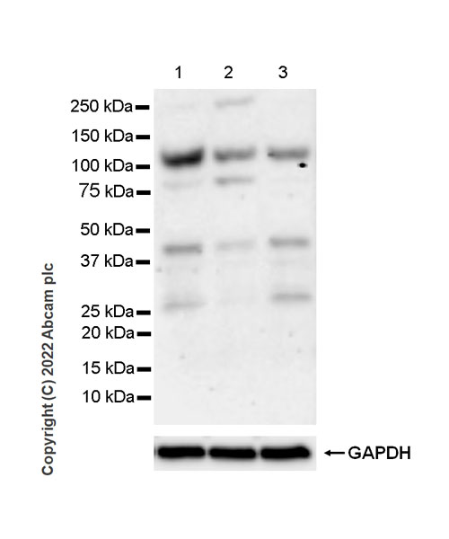 Western blot - Anti-RBM15B antibody [EPR25177-134] (BSA and Azide free) (ab300468), expandable thumbnail