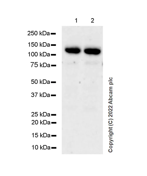 Western blot - Anti-RBM15B antibody [EPR25177-158] (AB300465)