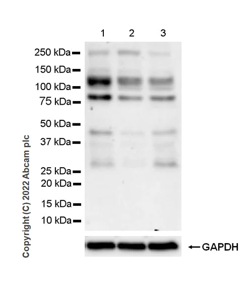 Western blot - Anti-RBM15B antibody [EPR25177-158] (BSA and Azide free) (AB300466)