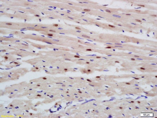 Immunohistochemistry (Formalin/PFA-fixed paraffin-embedded sections) - Anti-RBM20 antibody (AB214366)