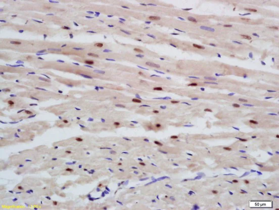 Immunohistochemistry (Formalin/PFA-fixed paraffin-embedded sections) - Anti-RBM20 antibody (AB214366)