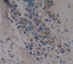 Immunohistochemistry (Formalin/PFA-fixed paraffin-embedded sections) - Anti-RBM20 antibody (AB233147)