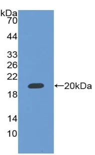 Western blot - Anti-RBM20 antibody (AB233147)