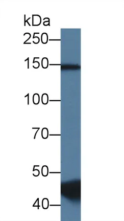 Western blot - Anti-RBM20 antibody (AB233147)