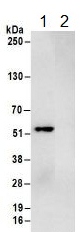 Immunoprecipitation - Anti-RBM22 antibody (AB157105)