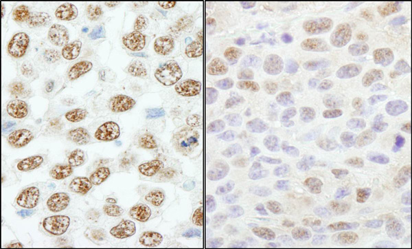 Immunohistochemistry (Formalin/PFA-fixed paraffin-embedded sections) - Anti-RBM25 antibody (AB72237)