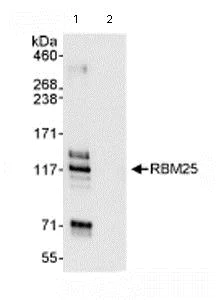 Immunoprecipitation - Anti-RBM25 antibody (AB72237)