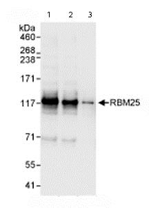 Western blot - Anti-RBM25 antibody (AB72237)