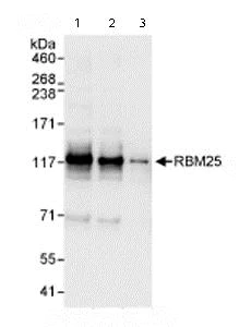 Western blot - Anti-RBM25 antibody (AB72237)
