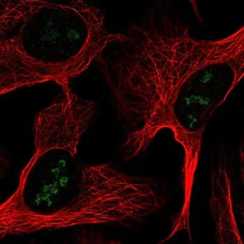 Immunocytochemistry/ Immunofluorescence - Anti-RBM28 antibody (AB150822)