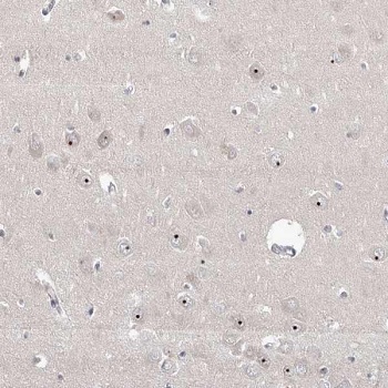Immunohistochemistry (Formalin/PFA-fixed paraffin-embedded sections) - Anti-RBM28 antibody (AB150822)