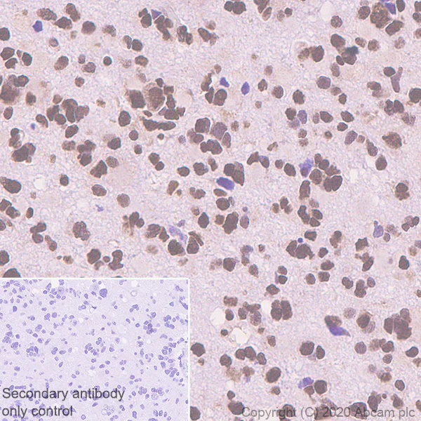 Immunohistochemistry (Formalin/PFA-fixed paraffin-embedded sections) - Anti-RBM3 antibody [EPR6061(2)] - BSA and Azide free (AB240089)