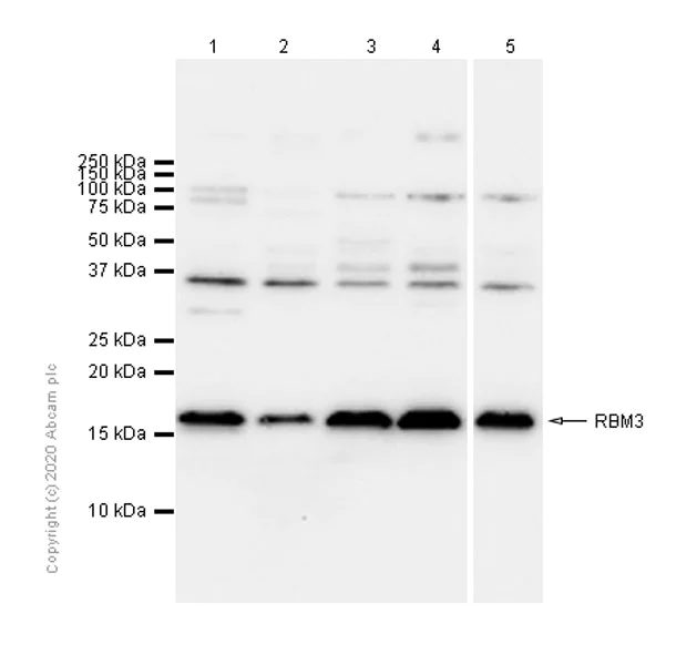 Western blot - Anti-RBM3 antibody [EPR6061(2)] - BSA and Azide free (AB240089)