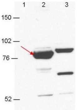 Western blot - Anti-RBM35A + RBM35B antibody [23A7.C9] (AB106555), expandable thumbnail