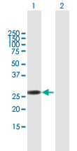 Western blot - Anti-RBM38 antibody (AB168445), expandable thumbnail