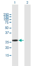 Western blot - Anti-RBM38 antibody (AB168445)
