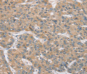 Immunohistochemistry (Formalin/PFA-fixed paraffin-embedded sections) - Anti-RBM38 antibody - C-terminal (AB200403)
