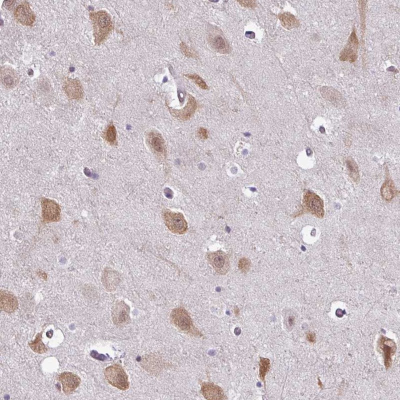 Immunohistochemistry (Formalin/PFA-fixed paraffin-embedded sections) - Anti-RBM4 antibody (AB251923)