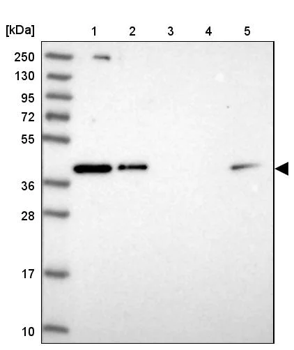Western blot - Anti-RBM4 antibody (AB251923)