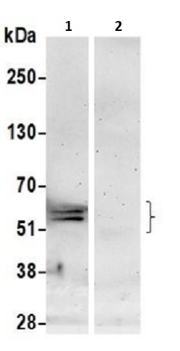Immunoprecipitation - Anti-RBM42 antibody (AB241504)