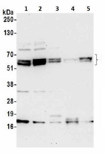 Western blot - Anti-RBM42 antibody (AB241504)