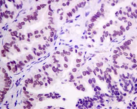Immunohistochemistry (Formalin/PFA-fixed paraffin-embedded sections) - Anti-RBM47 antibody [EPR9658] (AB167164)