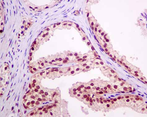 Immunohistochemistry (Formalin/PFA-fixed paraffin-embedded sections) - Anti-RBM47 antibody [EPR9658] (AB167164)
