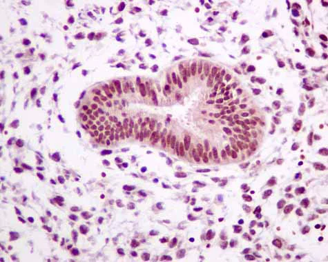 Immunohistochemistry (Formalin/PFA-fixed paraffin-embedded sections) - Anti-RBM47 antibody [EPR9658] (AB167164)