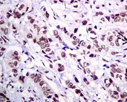 Immunohistochemistry (Formalin/PFA-fixed paraffin-embedded sections) - Anti-RBM47 antibody [EPR9658] (AB167164)