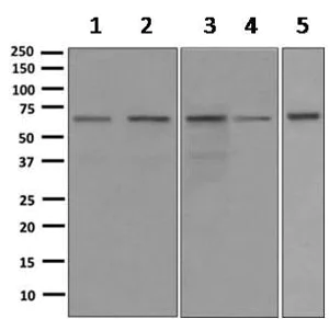 Western blot - Anti-RBM47 antibody [EPR9658] (AB167164)