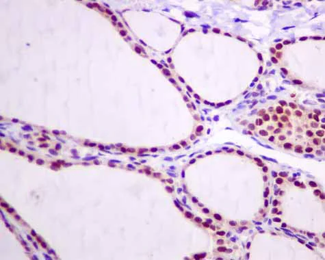 Immunohistochemistry (Formalin/PFA-fixed paraffin-embedded sections) - Anti-RBM47 antibody [EPR9658] - BSA and Azide free (AB249406)