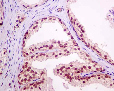 Immunohistochemistry (Formalin/PFA-fixed paraffin-embedded sections) - Anti-RBM47 antibody [EPR9658] - BSA and Azide free (AB249406)