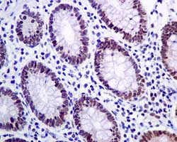 Immunohistochemistry (Formalin/PFA-fixed paraffin-embedded sections) - Anti-RBM47 antibody [EPR9658] - BSA and Azide free (AB249406)