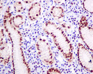 Immunohistochemistry (Formalin/PFA-fixed paraffin-embedded sections) - Anti-RBM47 antibody [EPR9659] (AB154176)